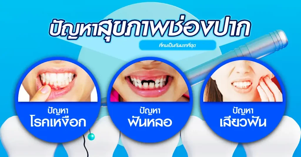 ปัญหาสุขภาพช่องปาก